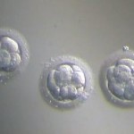 strage di embrioni al san filippo neri