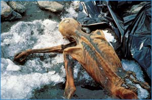 mummia-oetzi-globuli-rossi-conservati-5000-anni